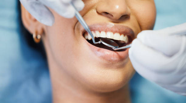 Best Emergency Dentist for Knocked-Out Tooth in Stroville, CA